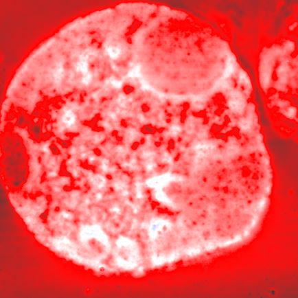 Blood_cell.JPG