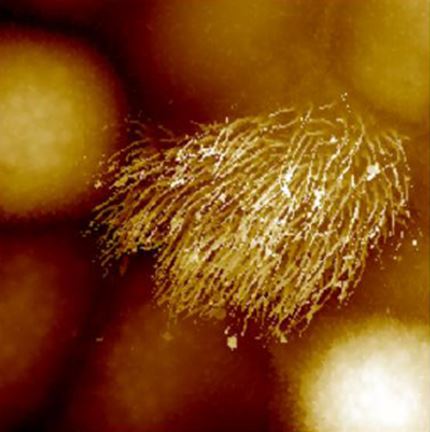 Rat_trachea_cell.JPG