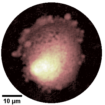 Human fibroblasts imaged with Digital Holographic Microscopy