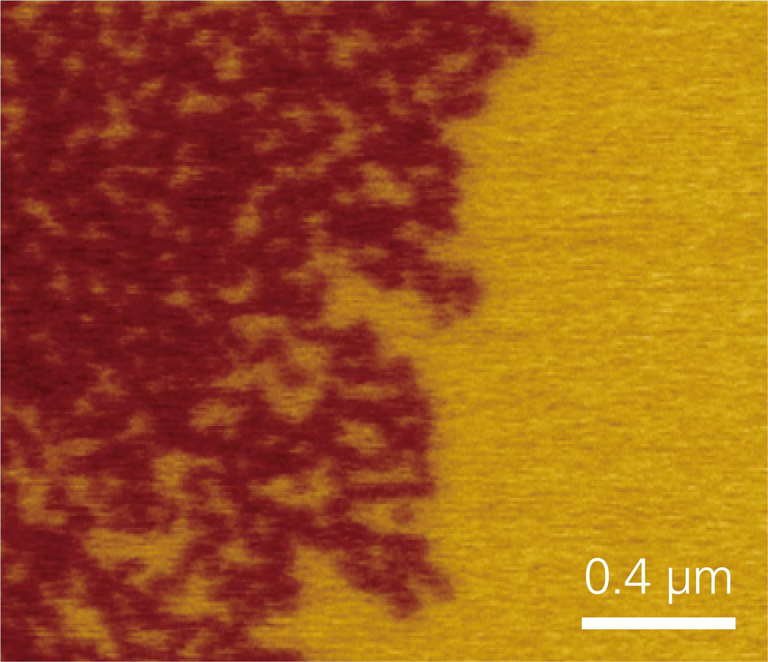 F14H20 microscopy image